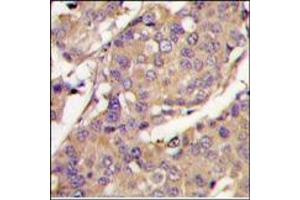Image no. 2 for anti-Ubiquitin-Conjugating Enzyme E2L 6 (UBE2L6) (C-Term) antibody (ABIN357496) (UBE2L6 anticorps  (C-Term))