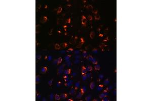 Immunofluorescence analysis of C6 cells using CCDC47 antibody (ABIN7266438) at dilution of 1:100. (CCDC47 anticorps  (AA 224-483))