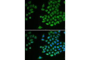 Immunofluorescence analysis of MCF-7 cells using PTPN2 antibody (ABIN5970915). (PTPN2 anticorps)