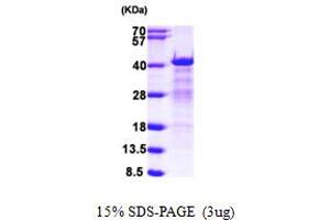 Heterogeneous Nuclear Ribonucleoprotein C (C1/C2) (HNRNPC) (AA 1-293) protein (His tag)