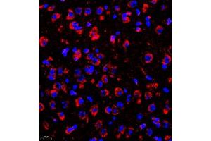 Immunofluorescence of paraffin embedded mouse brain using rasgrf1 (ABIN7073422) at dilution of 1:2000 (400x lens) (Cdc25 anticorps)