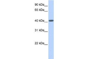 WB Suggested Anti-LRRC2 Antibody Titration:  0. (LRRC2 anticorps  (N-Term))