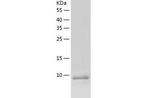 Western Blotting (WB) image for Prefoldin Subunit 1 (PFDN1) (AA 14-122) protein (His tag) (ABIN7124548) (PFDN1 Protein (AA 14-122) (His tag))