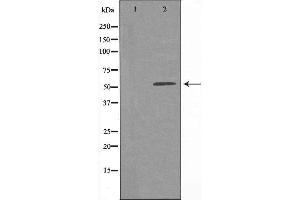 Western blot analysis of extracts from HepG2 cells using EIF2B4 antibody.