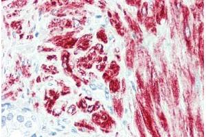 Human Prostate (formalin-fixed, paraffin-embedded) stained with DES antibody ABIN396919 at 10 ug/ml followed by biotinylated anti-mouse IgG secondary antibody ABIN481714, alkaline phosphatase-streptavidin and chromogen.