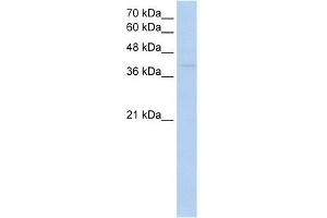 WB Suggested Anti-RNF165 Antibody Titration:  0. (RNF165 anticorps  (Middle Region))