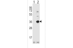 Western blot analysis of CASP3 (arrow) using rabbit polyclonal CASP3 Antibody (Center) (ABIN391813 and ABIN2841662).