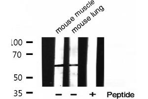 Western blot analysis of Phospho-HDAC2 (Ser394) expression in various lysates