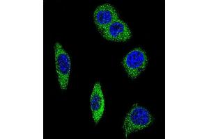 Confocal immunofluorescent analysis of ADRA2B Antibody (Center) (ABIN652506 and ABIN2842340) with MDA-M cell followed by Alexa Fluor® 488-conjugated goat anti-rabbit lgG (green). (ADRA2B anticorps  (AA 343-369))