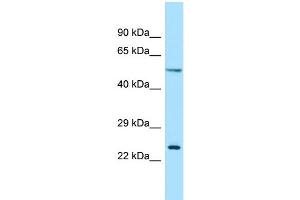 WB Suggested Anti-RAB30 Antibody Titration: 1.