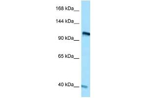 WB Suggested Anti-RET Antibody Titration: 1. (Ret Proto-Oncogene anticorps  (C-Term))