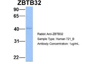 Host: Rabbit Target Name: WT1 Sample Type: 721_B Antibody Dilution: 1. (ZBTB32 anticorps  (N-Term))