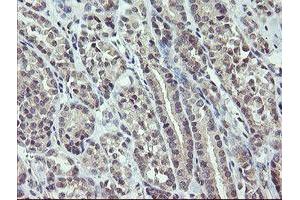 Image no. 1 for anti-Zinc Finger, BED-Type Containing 1 (ZBED1) antibody (ABIN1501793)