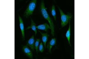 IF analysis of FAAH1/FAAH using anti-FAAH1/FAAH antibody (ABIN7601397). (FAAH anticorps  (AA 34-579))