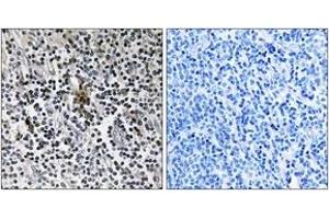 Immunohistochemistry analysis of paraffin-embedded human tonsil tissue, using RPS3 Antibody.