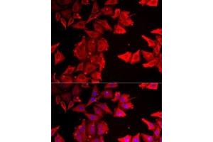 Immunofluorescence analysis of MCF7 cells using THRSP Polyclonal Antibody (THRSP anticorps)