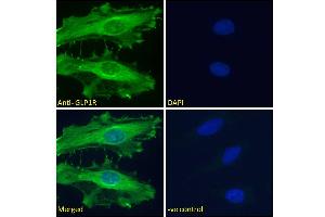 ABIN5539774 Immunofluorescence analysis of paraformaldehyde fixed HeLa cells, permeabilized with 0.