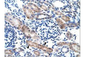 Image no. 1 for anti-Chloride Intracellular Channel 1 (CLIC1) (AA 62-111) antibody (ABIN202109)