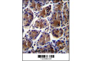 GIF Antibody immunohistochemistry analysis in formalin fixed and paraffin embedded human stomach tissue followed by peroxidase conjugation of the secondary antibody and DAB staining. (Intrinsic Factor anticorps  (AA 189-218))