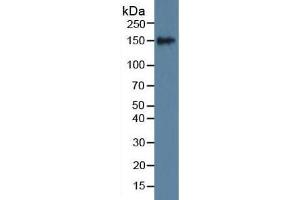 Rabbit Detection antibody from the kit in WB with Positive Control: Sample Mouse serum. (SLIT1 Kit ELISA)