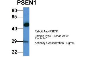 Host: Rabbit  Target Name: PSEN1  Sample Tissue: Human Adult Placenta  Antibody Dilution: 1. (Presenilin 1 anticorps  (Middle Region))