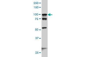ACTN4 monoclonal antibody (M01A), clone 4D10 Western Blot analysis of ACTN4 expression in Hela S3 NE . (alpha Actinin 4 anticorps  (AA 592-701))