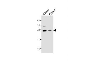 All lanes : Anti-NTF3 Antibody (C-term) at 1:2000 dilution Lane 1: Human brain lysate Lane 2: Rat brain lysate Lysates/proteins at 20 μg per lane. (Neurotrophin 3 anticorps  (C-Term))