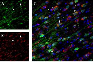 anti-Protein Phosphatase 1, Regulatory (Inhibitor) Subunit 1B (PPP1R1B) (AA 160-174), (C-Term), (Intracellular) antibody