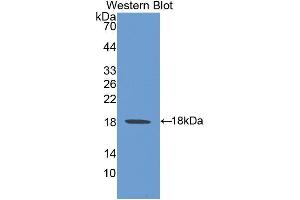 Western Blotting (WB) image for anti-Heat Shock 105kDa/110kDa Protein 1 (HSPH1) (AA 595-733) antibody (ABIN1078105) (HSPH1 anticorps  (AA 595-733))