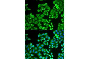 Immunofluorescence analysis of U2OS cells using PPP4C antibody. (PPP4C anticorps  (AA 1-307))