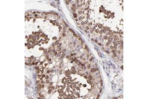 Immunohistochemical staining of human testis with NSF polyclonal antibody  shows cytoplasmic positivity in cells of seminiferus ducts at 1:50-1:200 dilution.