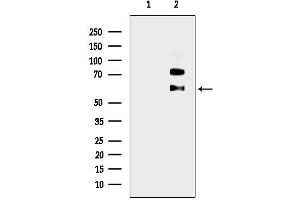 Western blot analysis of lysates from MCF7 cells(serum starvation treatment), using SRMS Antibody.