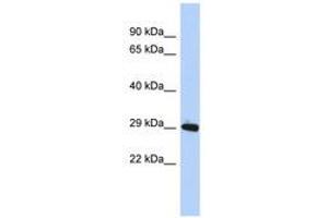 Image no. 1 for anti-Zinc Finger Protein 524 (ZNF524) (AA 35-84) antibody (ABIN6740642) (ZNF524 anticorps  (AA 35-84))