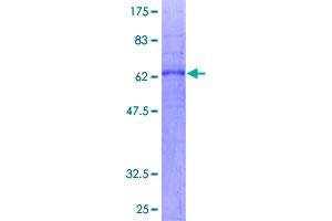 Image no. 1 for Prostacyclin Receptor (PTGIR) protein (GST tag) (ABIN1316746)