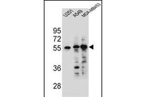 SYNCI Antibody (N-term) (ABIN654757 and ABIN2844441) western blot analysis in ,A549 and MDA-M cell line lysates (35 μg/lane). (Syncoilin anticorps  (N-Term))
