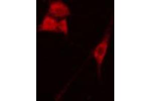 ABIN6267367 staining Hela cells by IF/ICC.