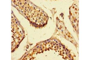 Immunohistochemistry of paraffin-embedded human testis tissue using ABIN7168986 at dilution of 1:100 (STK25 anticorps  (AA 1-426))