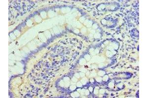 Immunohistochemistry of paraffin-embedded human small intestine tissue using ABIN7147585 at dilution of 1:100