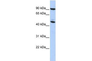 WB Suggested Anti-MECP2 Antibody Titration:  0. (MECP2 anticorps  (N-Term))