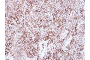 IHC-P Image Immunohistochemical analysis of paraffin-embedded FaDu xenograft, using Caveolin 2, antibody at 1:500 dilution.