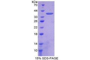 SDS-PAGE (SDS) image for Induced Myeloid Leukemia Cell Differentiation Protein Mcl-1 (MCL1) (AA 6-328) protein (His tag) (ABIN2125981)
