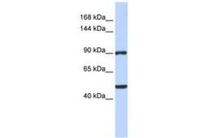 Image no. 1 for anti-Zinc Finger Protein 217 (ZNF217) (AA 540-589) antibody (ABIN6742392) (ZNF217 anticorps  (AA 540-589))