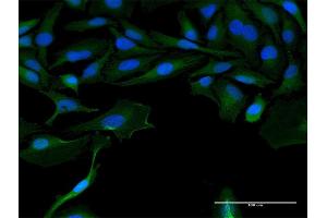 Immunofluorescence of purified MaxPab antibody to LOC541473 on HeLa cell. (LOC541473 anticorps  (AA 1-131))