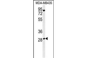 Western blot analysis of RRAGD Antibody in MDA-MB435 cell line lysates (35ug/lane)