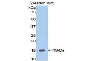 Western Blotting (WB) image for anti-Alanine Aminotransferase (ALT) (AA 367-480) antibody (ABIN1077756) (ALT anticorps  (AA 367-480))