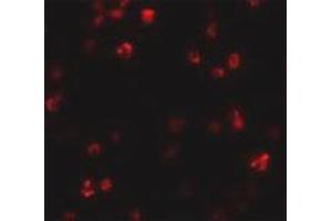Immunofluorescence staining of human spleen tissue with 20 ug/mL FRMPD1 polyclonal antibody . (FRMPD1 anticorps  (C-Term))