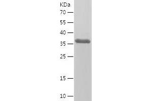 Western Blotting (WB) image for Chemokine Binding Protein 2 (CCBP2) (AA 315-384) protein (His-IF2DI Tag) (ABIN7122348)