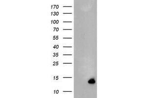 Image no. 1 for anti-Chromosome 17 Open Reading Frame 37 (C17orf37) antibody (ABIN1501776) (C17orf37 anticorps)