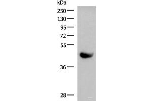 Western blot analysis of Human plasma solution using KIR2DL5A Polyclonal Antibody at dilution of 1:1000 (KIR2DL5A anticorps)