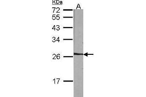 WB Image Sample (30 ug of whole cell lysate) A:NIH-3T3 12% SDS PAGE antibody diluted at 1:1000 (NME5 anticorps  (Center))
